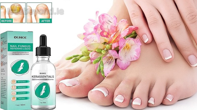 Kerassentials Oil Packaging Photo